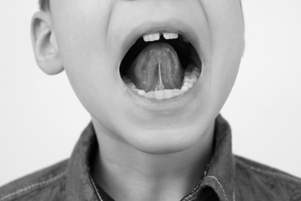 <p>Curso Intervención quirúrgica interdisciplinar en el <strong>frenillo lingual durante el ciclo vital</strong></p>